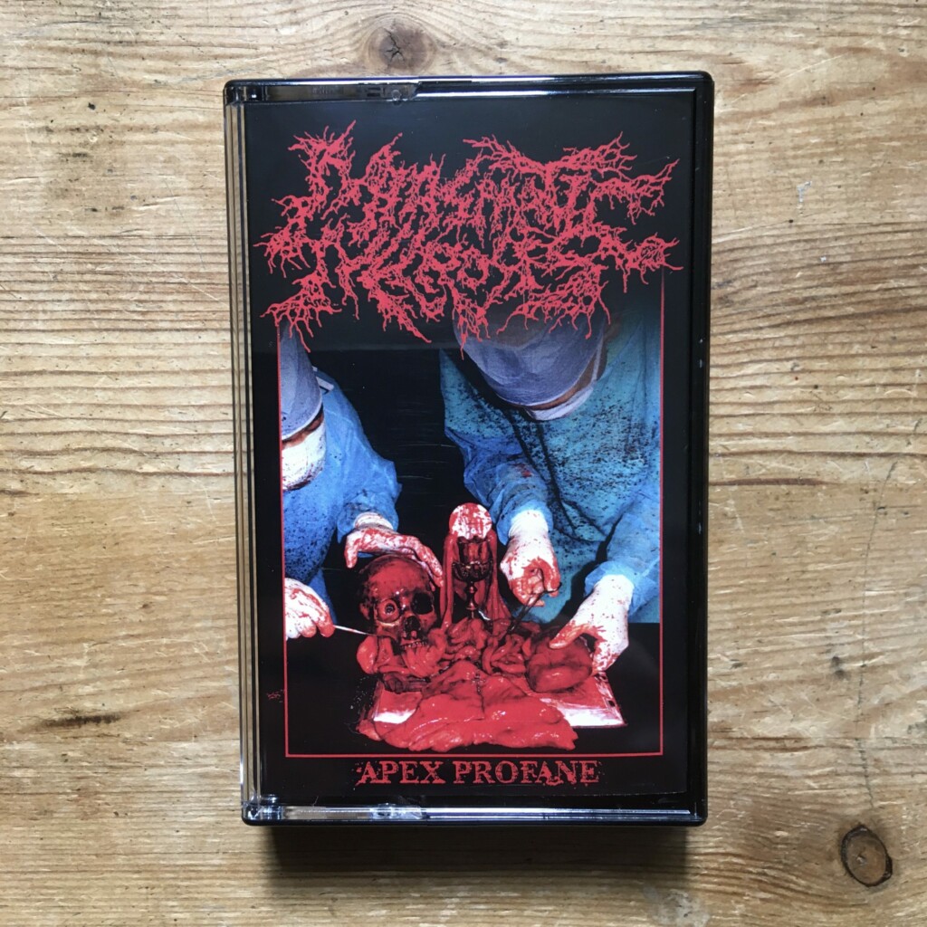 Miasmatic Necrosis – Apex Profane Pro Tape