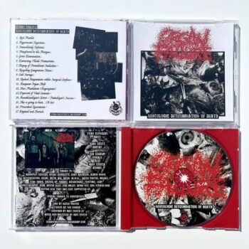 Organ Failure - Neurologic Determination of Death CD